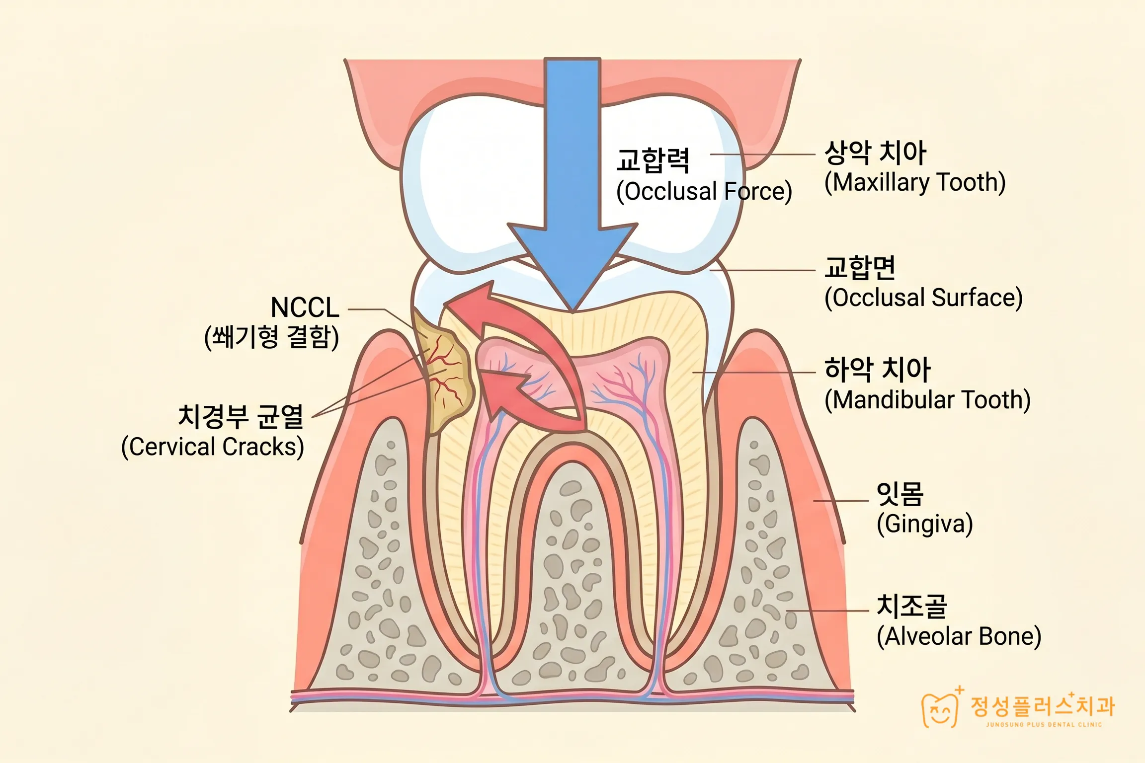 화곡 치과 양치할 때 찬물이 닿으면 소름 끼치게 시린 이유가 있습니다.