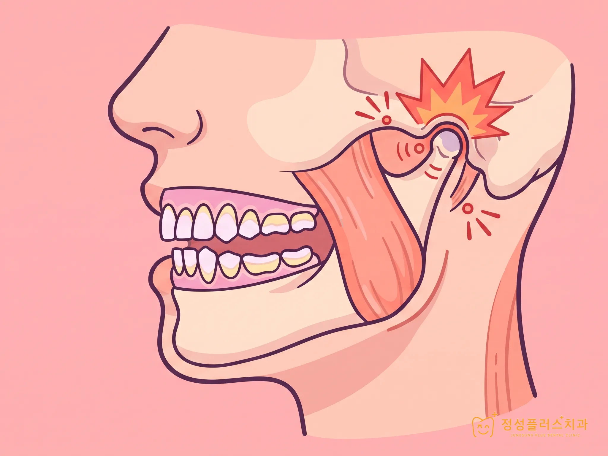 화곡 치과 자고 일어나면 볼에 치아 자국이 생기는 이유는?